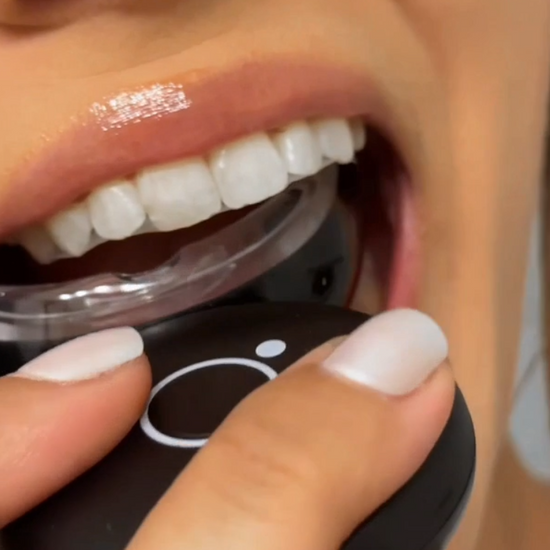 LED Teeth Whitening Video