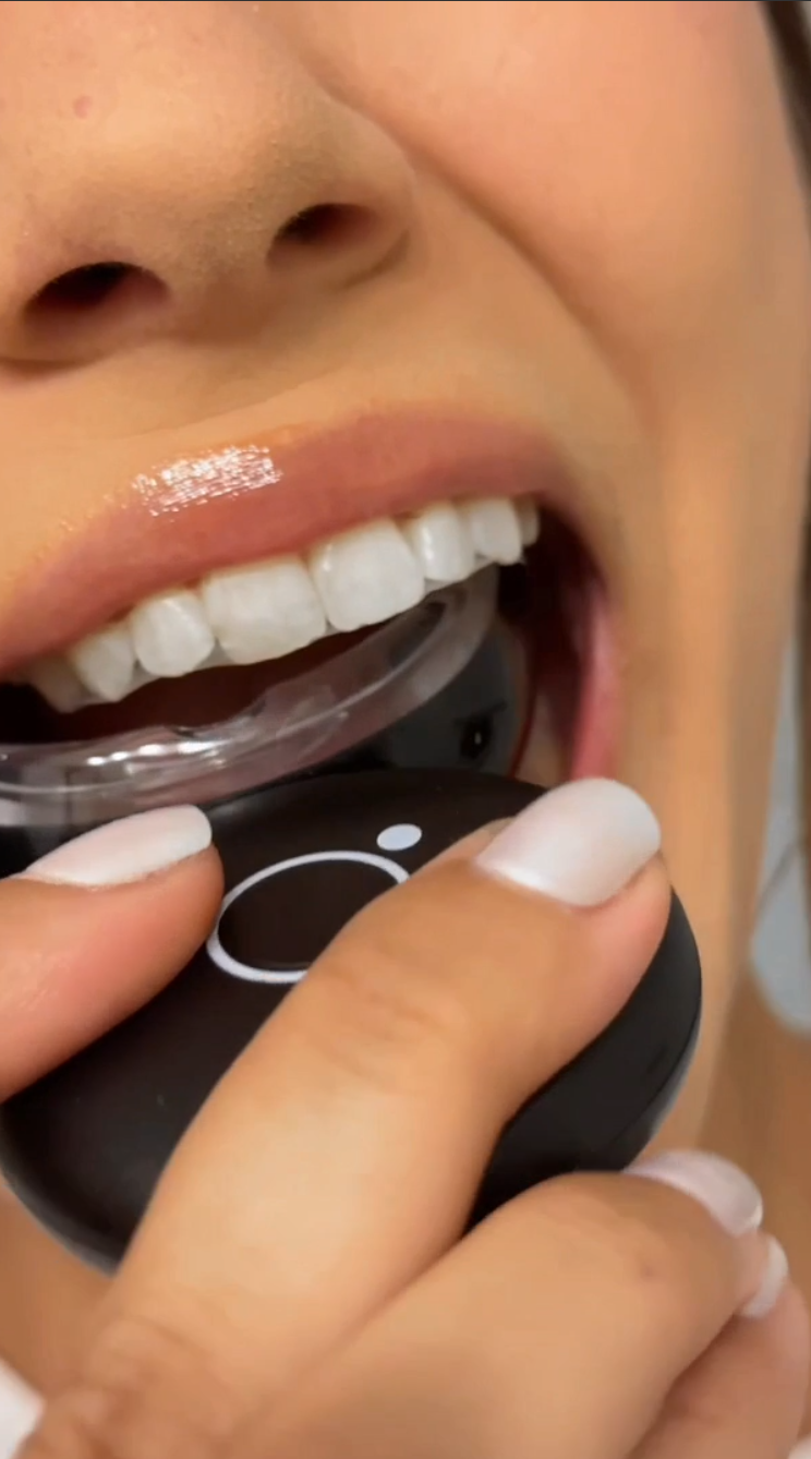 LED Teeth Whitening Video