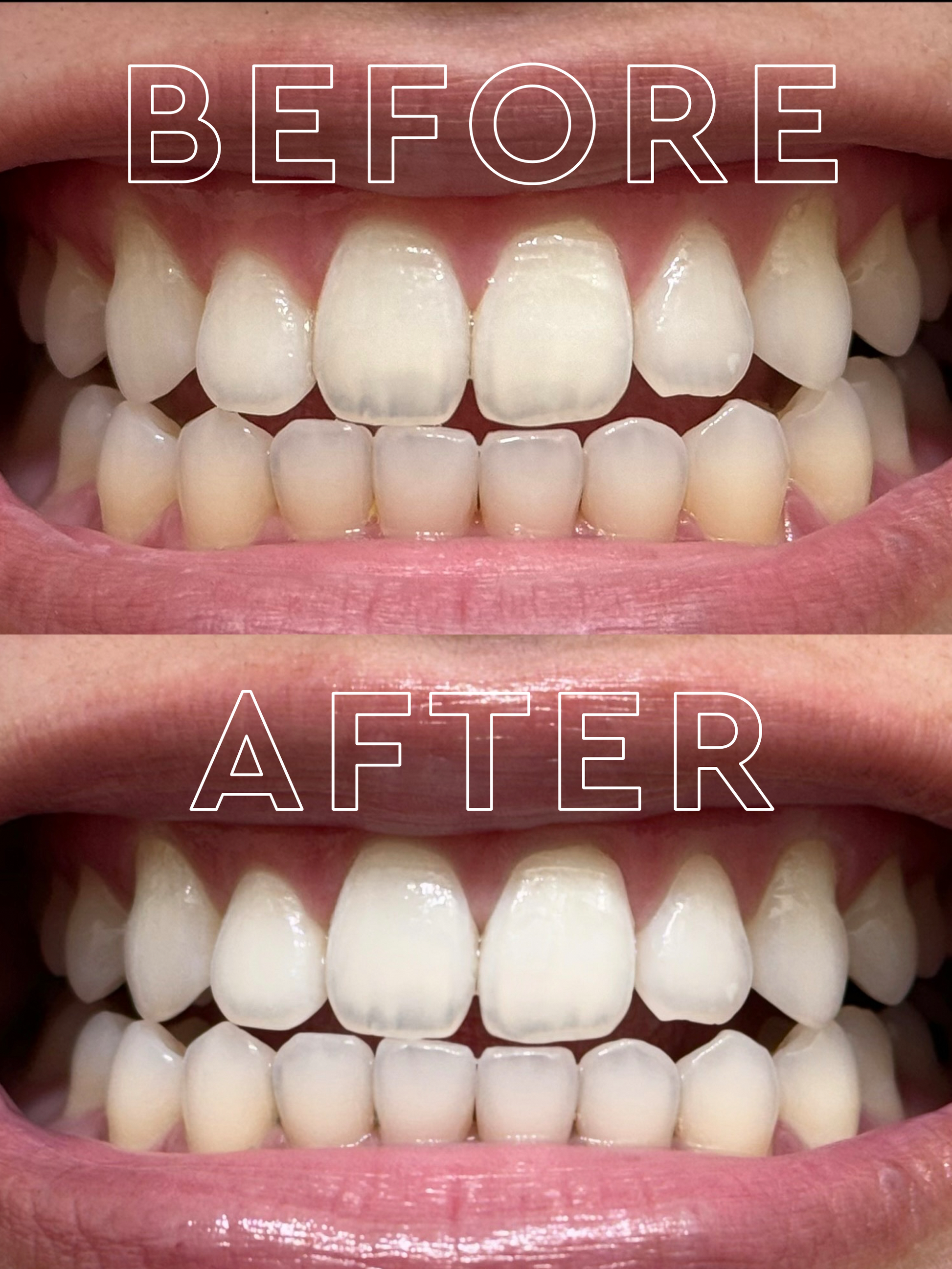 purple toothpaste before after
